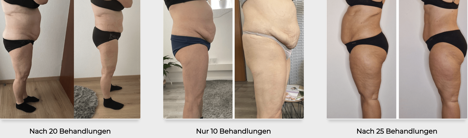 Ergebnisse nach 10, 20 und 25 Behandlungen