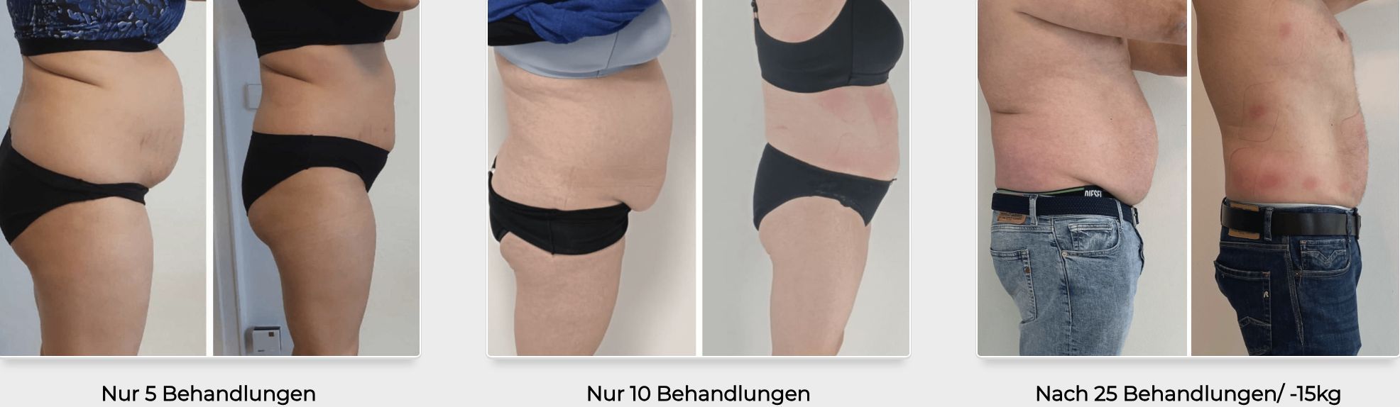 Ergebnisse nach 5, 10 und 25 Behandlungen