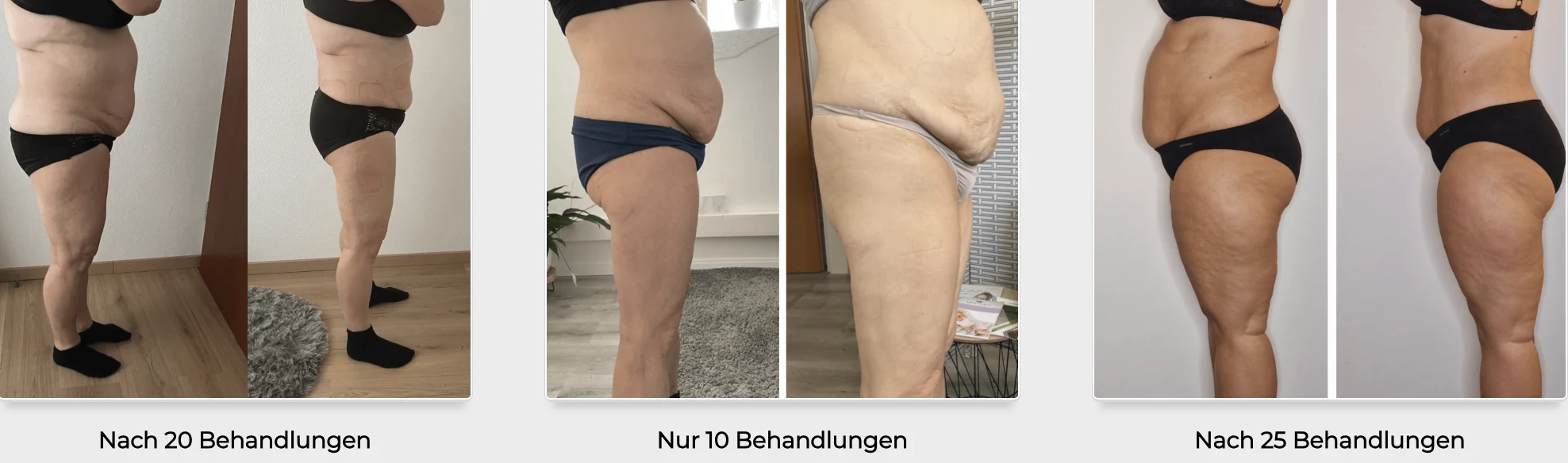Ergebnisse nach 10, 20 und 25 Behandlungen